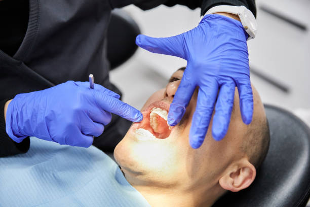 Best Emergency Treatment for Dental Infections or Abscesses in Pacific Grove, CA