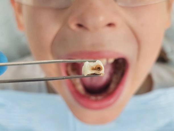 Best After-Hours Dental Trauma Care in Pacific Grove, CA